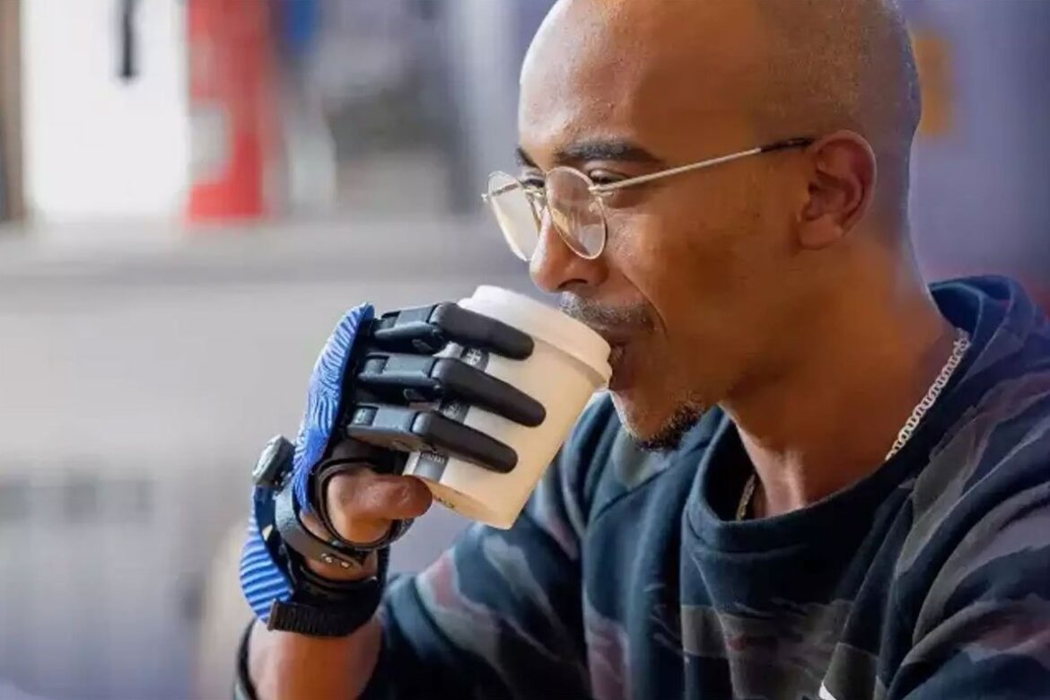 bionički prsti bionički prsti